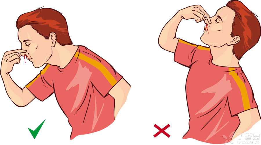 �ǳ�Ѫ���㻹�ڴ������ͷֹѪô��