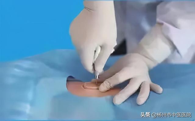 ���贩��ͿƬ���