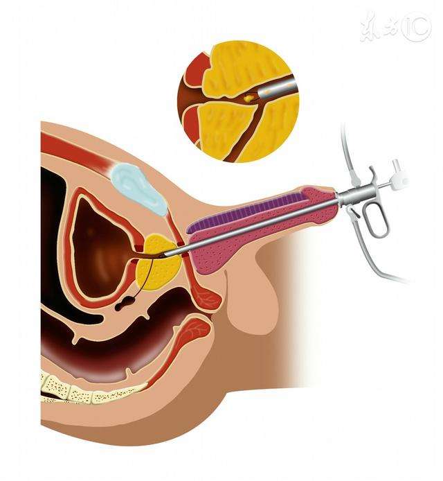 ���׾����